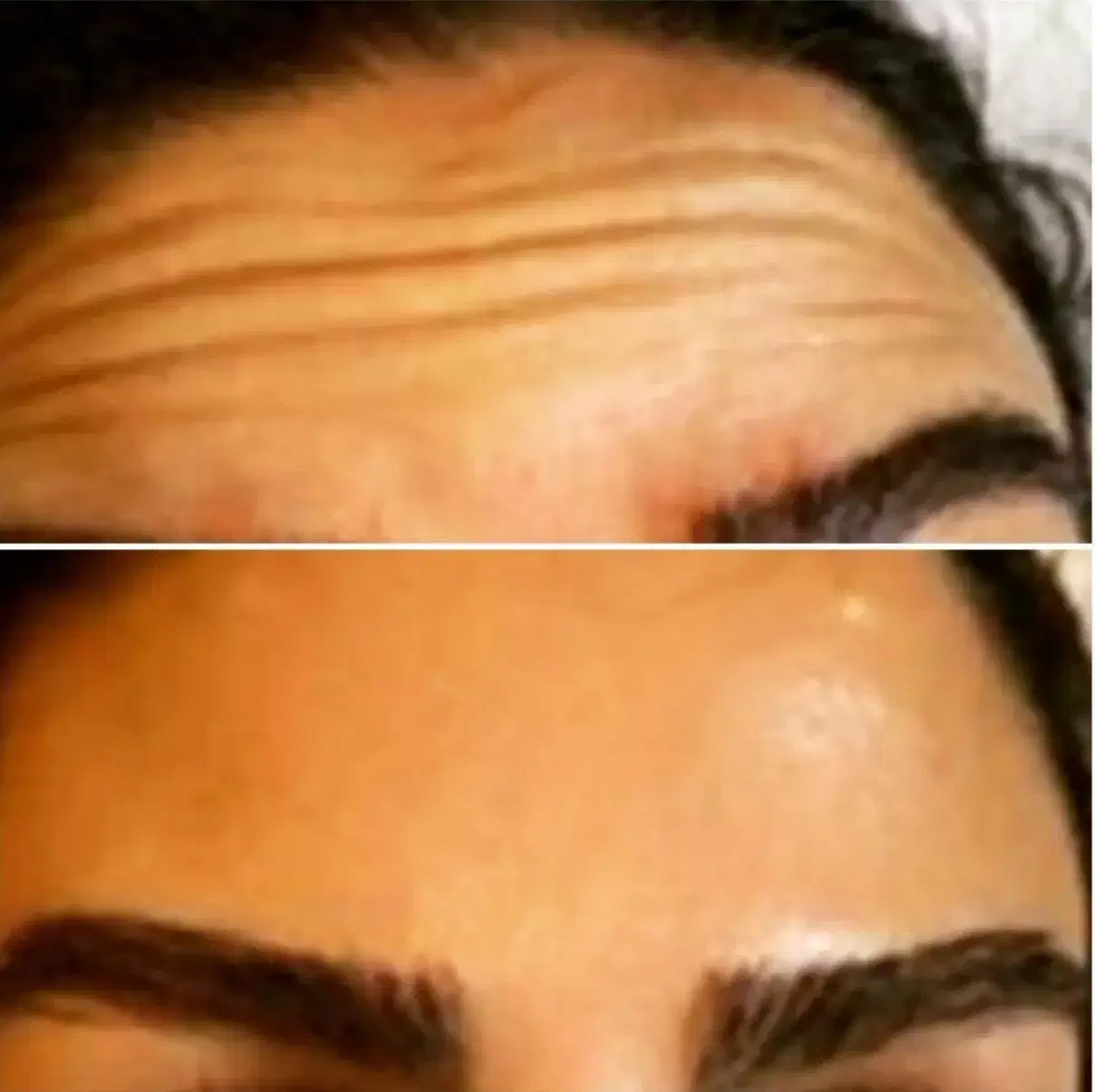 خانه ی لیزر آیدالین شهرک ارم (پوست وزیبایی )|خدمات زیبایی و سلامت|تبریز, |دیوار