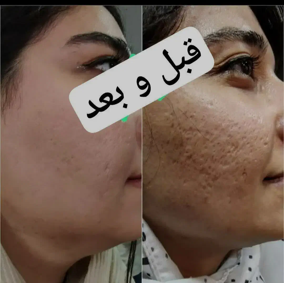 کرمvip|آرایشی، بهداشتی، درمانی|زابل, |دیوار