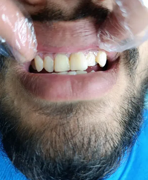 دندانپزشکی در خرم آباد با تخفیف ویژه|خدمات آرایشگری و زیبایی|دورود, |دیوار