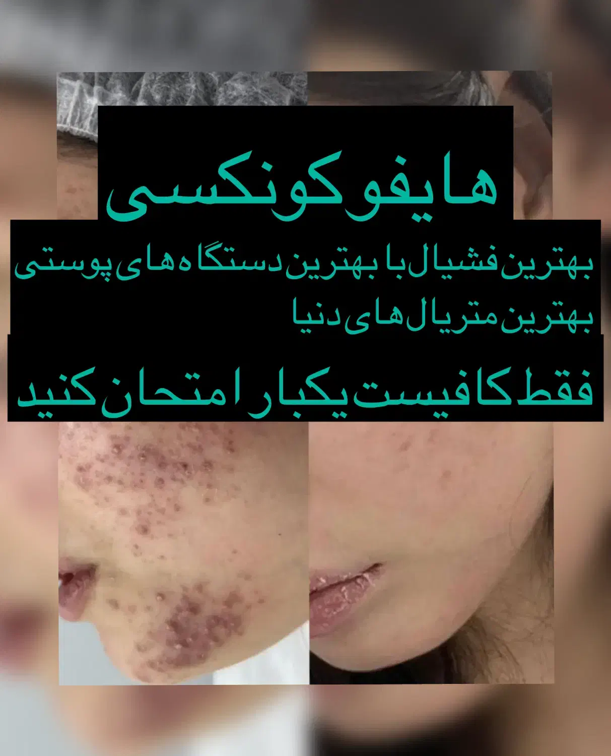 فشیال معجزه ۳سال جوان شوید|خدمات آرایشگری و زیبایی|سبزوار, فرهنگیان|دیوار