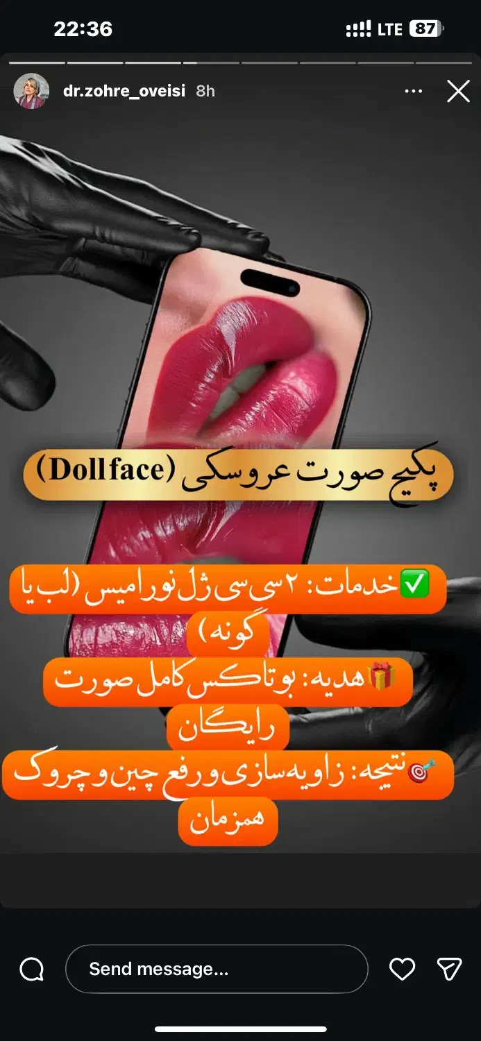 لیزر موهای بدن|خدمات آرایشگری و زیبایی|زاهدان, |دیوار