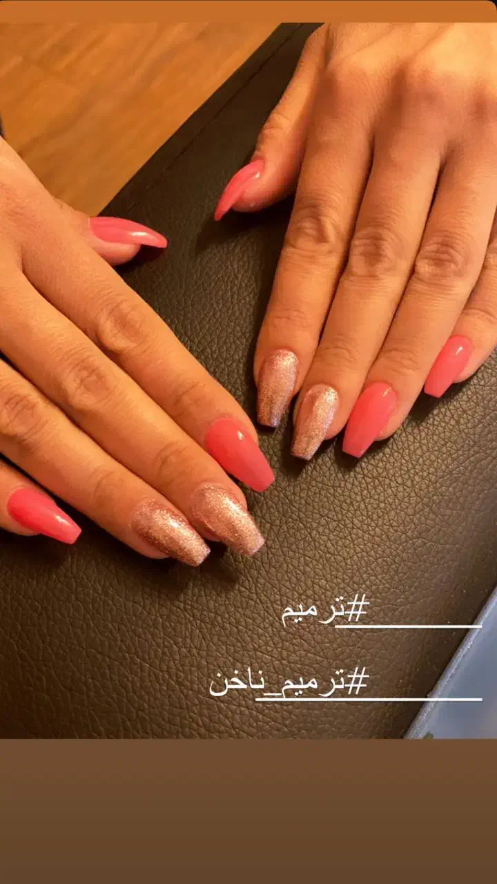 تخفیف ویژه یلدا|خدمات آرایشگری و زیبایی|تهران, دکتر هوشیار|دیوار