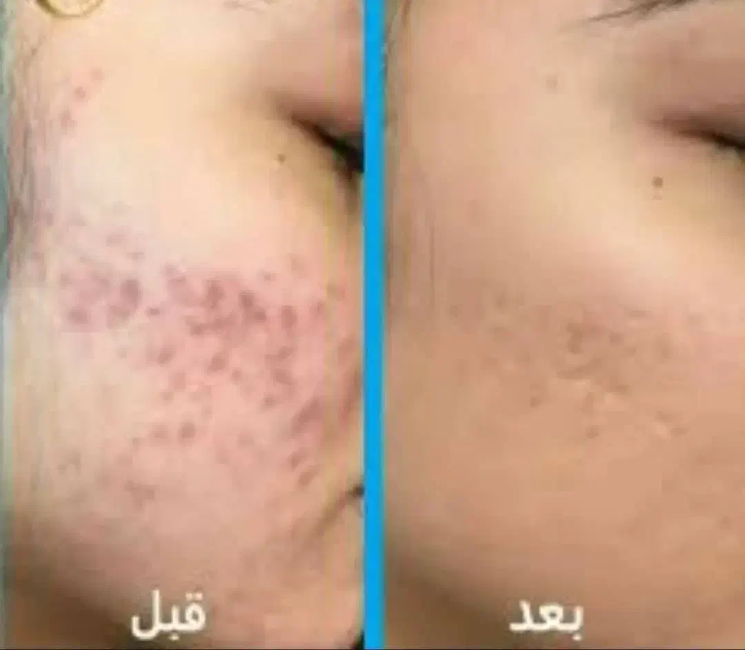 سلام روغن های خوراکی ورق بزنید|آرایشی، بهداشتی، درمانی|محمدیه-قزوین, |دیوار