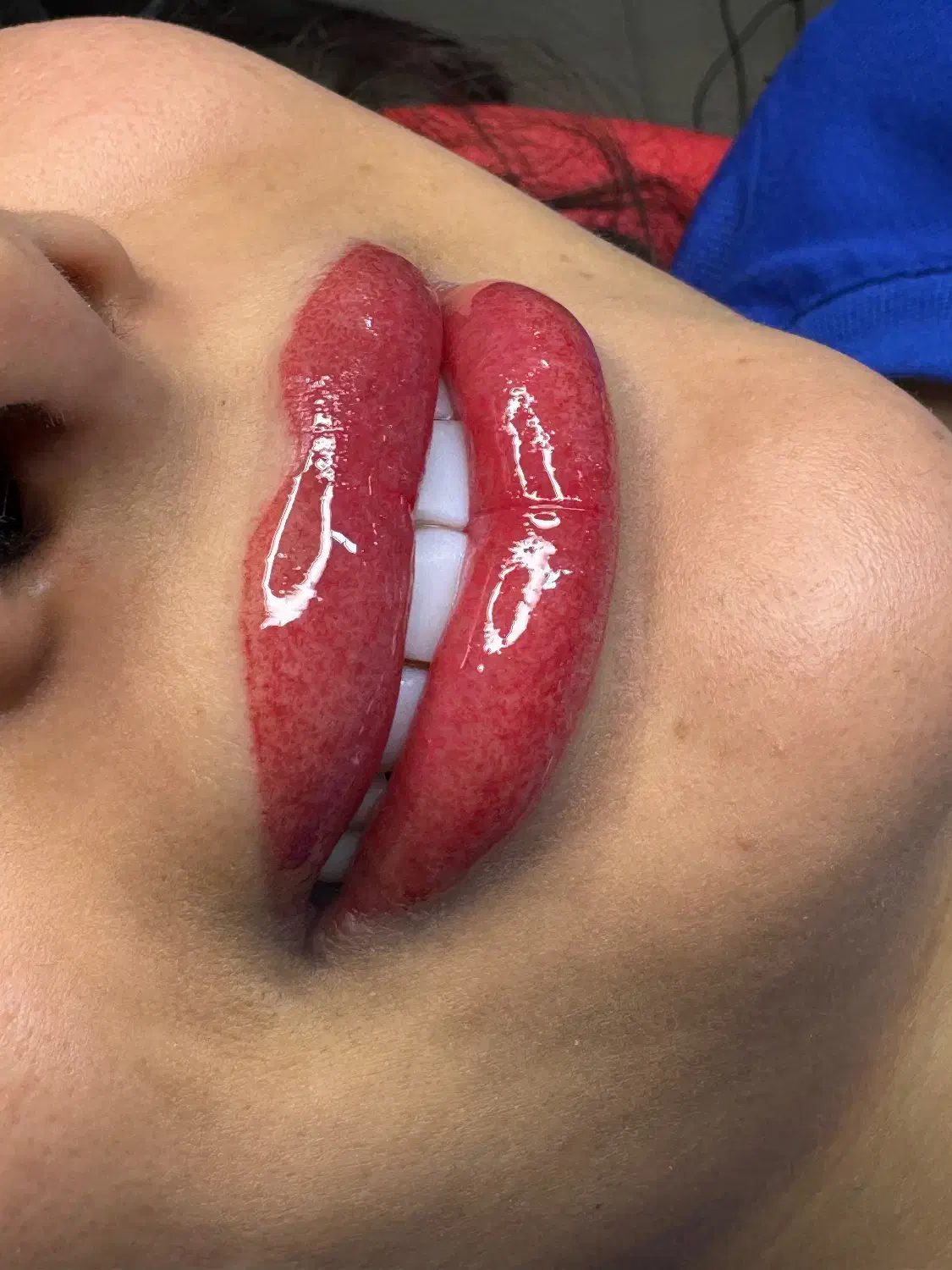 شیدینگ لب و رفع تیرگی لب|خدمات آرایشگری و زیبایی|بوشهر, |دیوار