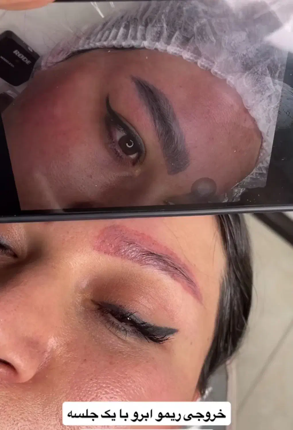 آرایش دائم میکرو ابرو شید لب ریموو تاتو های قدیمی|خدمات آرایشگری و زیبایی|قائمشهر, |دیوار