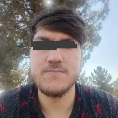 برداشتن انواع زگیل، خال و لک پوستی،فیشیال در منزل|خدمات آرایشگری و زیبایی|تهران, ظفر|دیوار