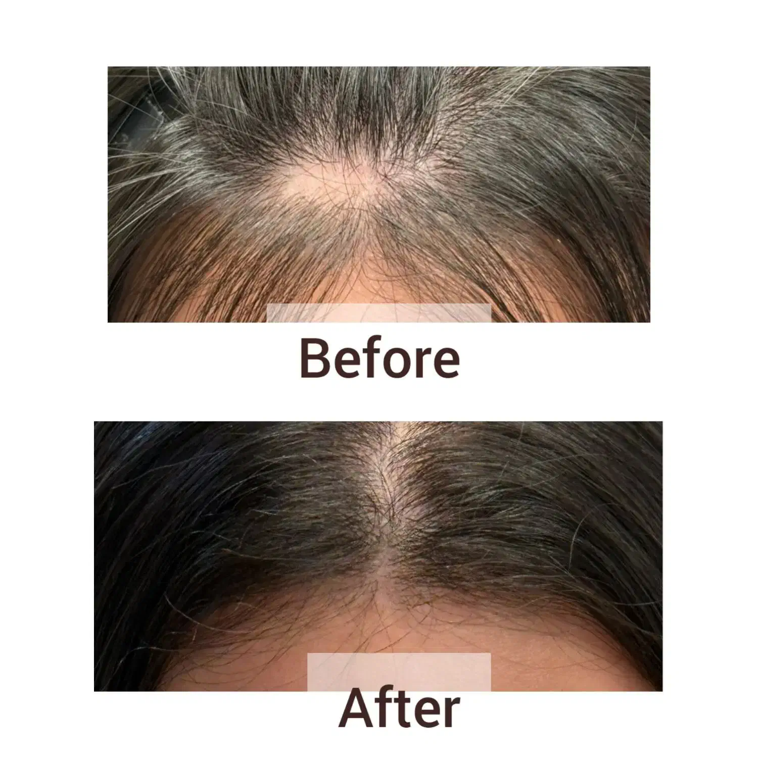 تخفیف ویژه پی آر پی|آرایشی، بهداشتی، درمانی|بهبهان, |دیوار