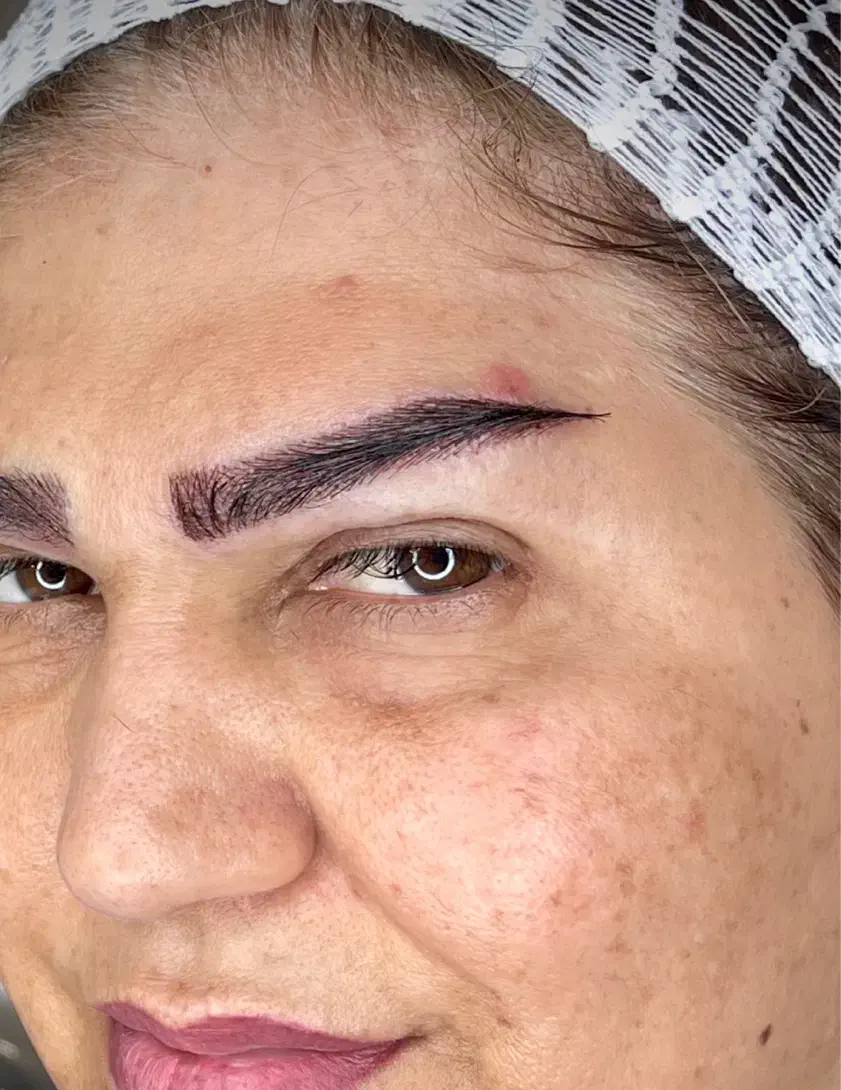 «کاشت ابرو طبیعی در بوشهر تیم پزشکی مجرب|خدمات آرایشگری و زیبایی|بوشهر, |دیوار