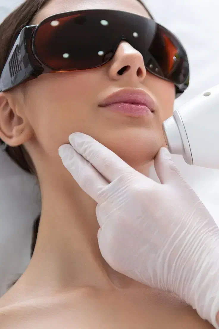 یلدای بدون مو....|خدمات آرایشگری و زیبایی|شهرکرد, |دیوار