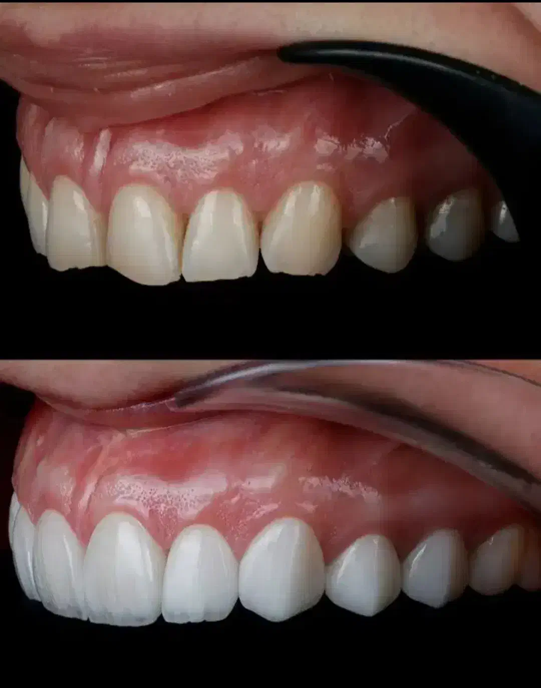 دندون پزشکی|خدمات آرایشگری و زیبایی|خرم‌آباد, |دیوار