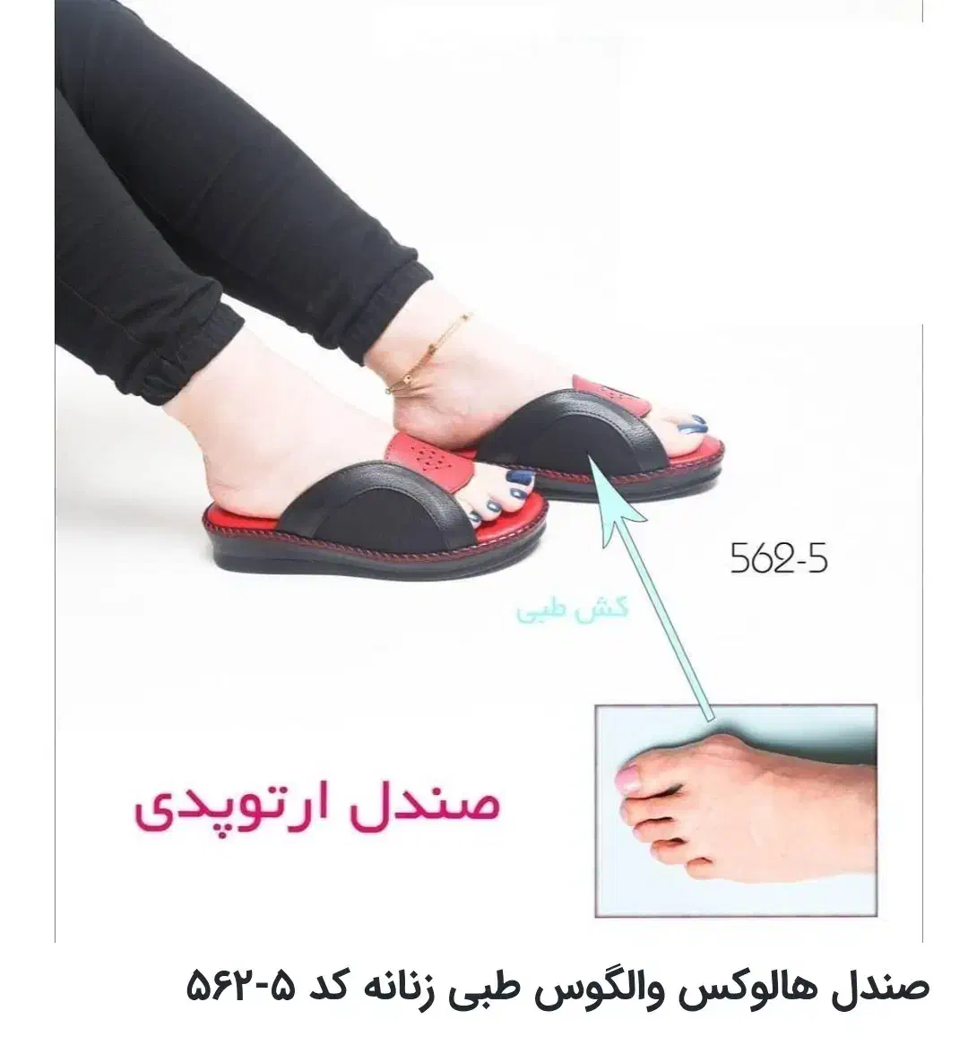 دمپایی طبی مخصوص هالوکس والگوس|کیف، کفش، کمربند|اردبیل, |دیوار