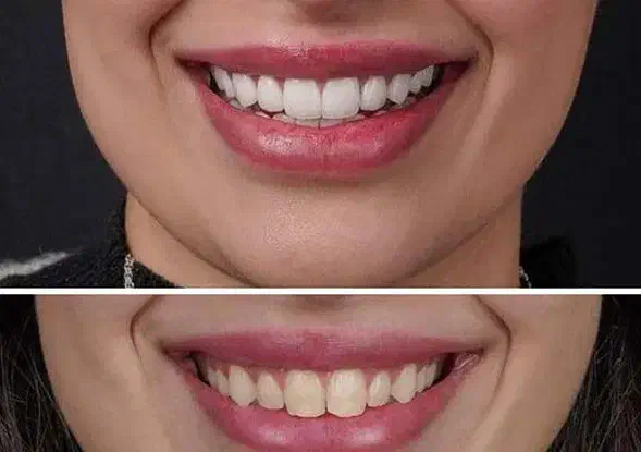 جشنواره یلدایی خدمات دندانپزشکی شهر سهند|خدمات آرایشگری و زیبایی|سهند, |دیوار