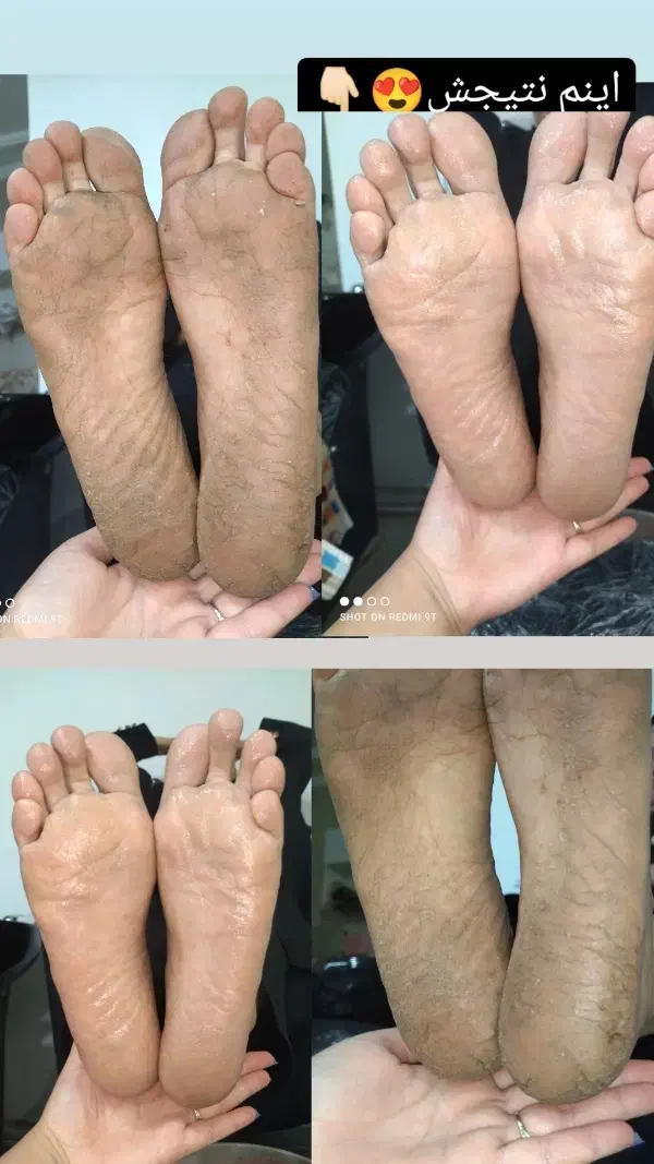 یه لحظه رد نکن بیا ببین پدیکور پارو|خدمات آرایشگری و زیبایی|محمدیه-قزوین, |دیوار