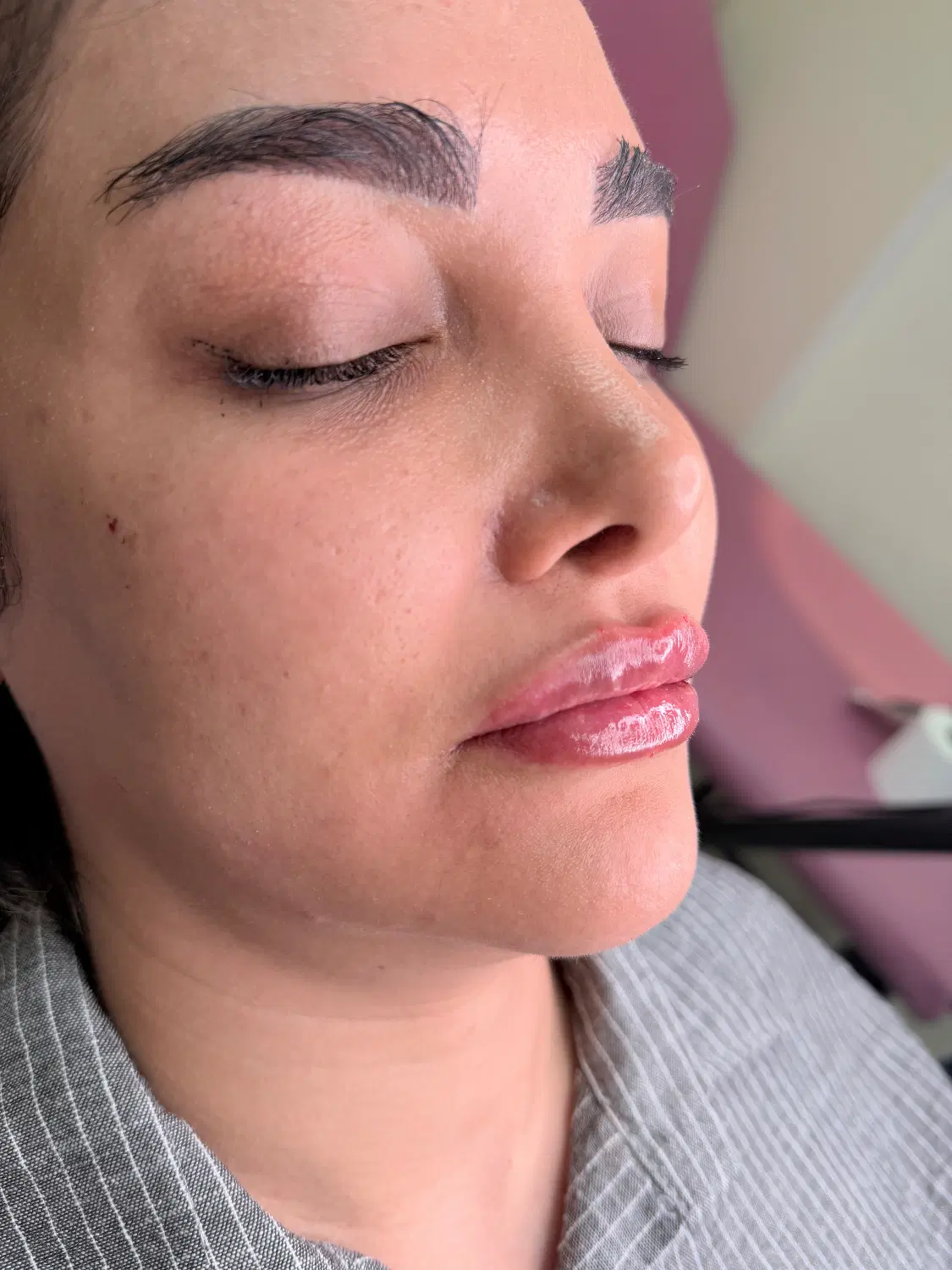 مطب تزریق فیلر(ژل)لب بادی کانتور چانه لیفت بوتاکس|خدمات زیبایی و سلامت|تهران, امامت|دیوار