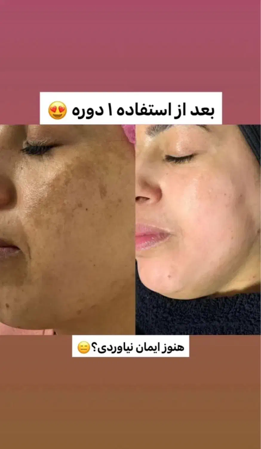 کرم ضدلک لاکچری کوین(کرم ۸ کاره)|آرایشی، بهداشتی، درمانی|شیراز, ملاصدرا|دیوار