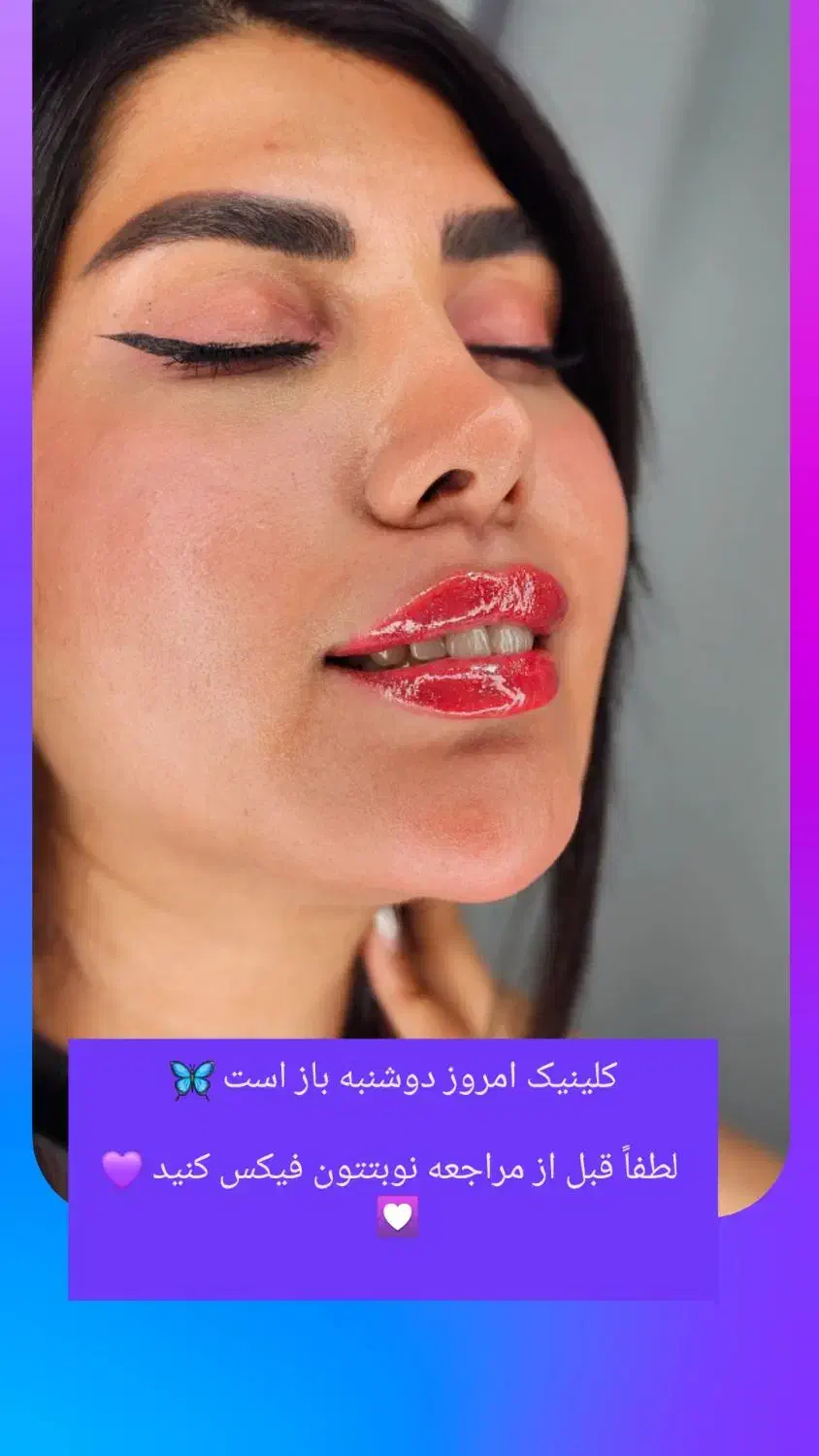 جذب اسکین کر(فیشال)در کلینیک زیبایی|استخدام درمانی، زیبایی، بهداشتی|بندرعباس, |دیوار