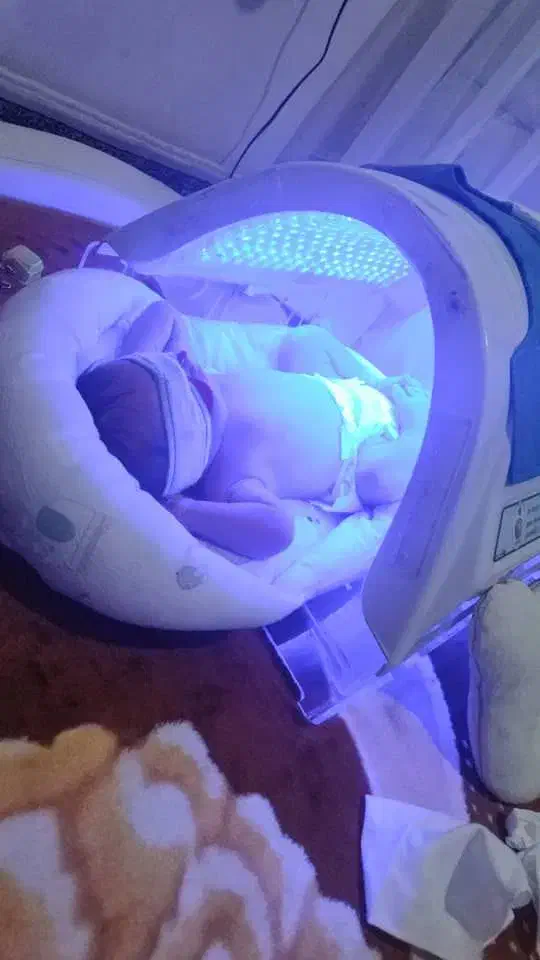 اجاره دستگاه زردی نوزاد بیمارستانی جدید و تضمینی|خدمات آرایشگری و زیبایی|کرج, اصفهانیها|دیوار