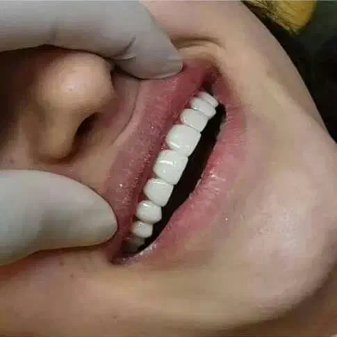 دندانپزشکی و زیبایی لبخند، تعرفه دولتی|خدمات آرایشگری و زیبایی|تهران, جمالزاده|دیوار