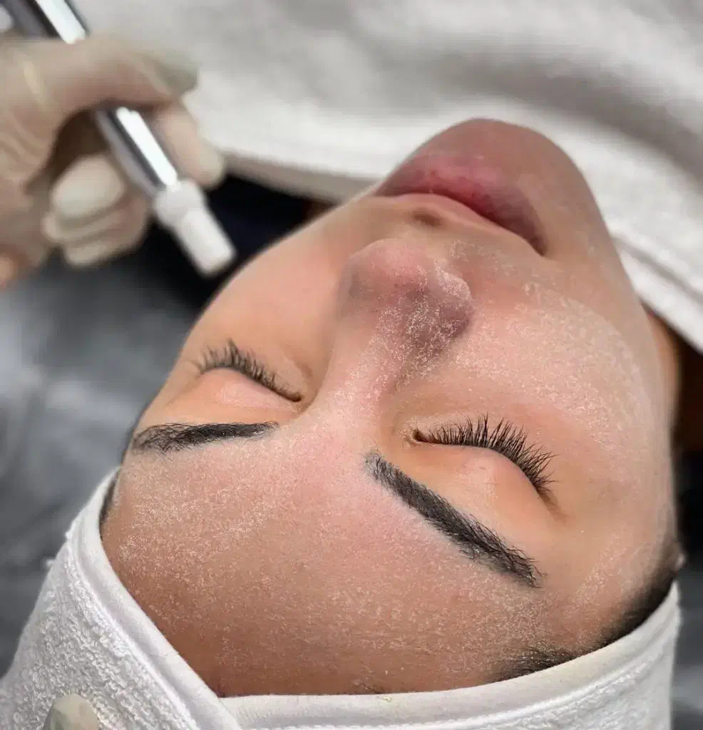 تخفیفات ویژه پاکسازی پوست.فشیال فقط 400|خدمات آرایشگری و زیبایی|شاهین‌شهر, نظامی|دیوار