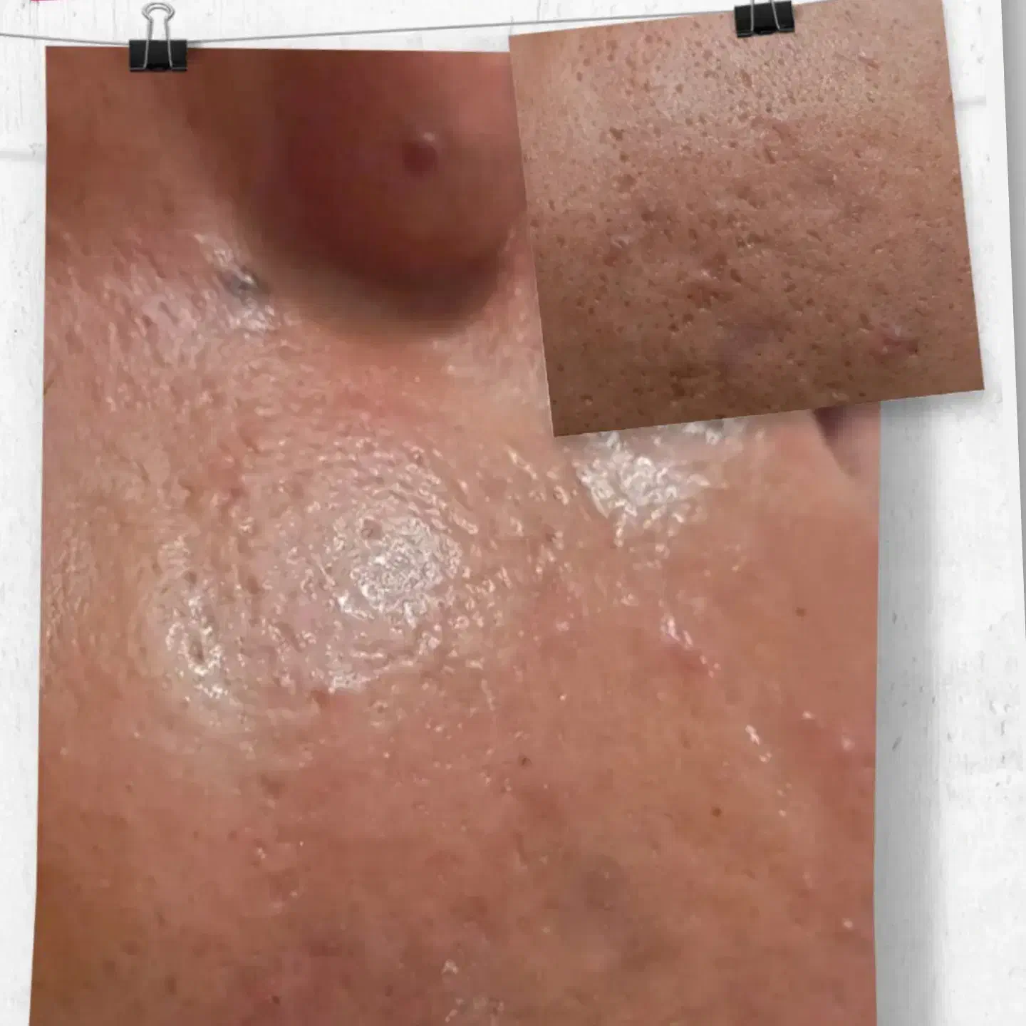 جشنواره یلدایی فیشال تخصصی و درمانی|خدمات آرایشگری و زیبایی|همدان, |دیوار