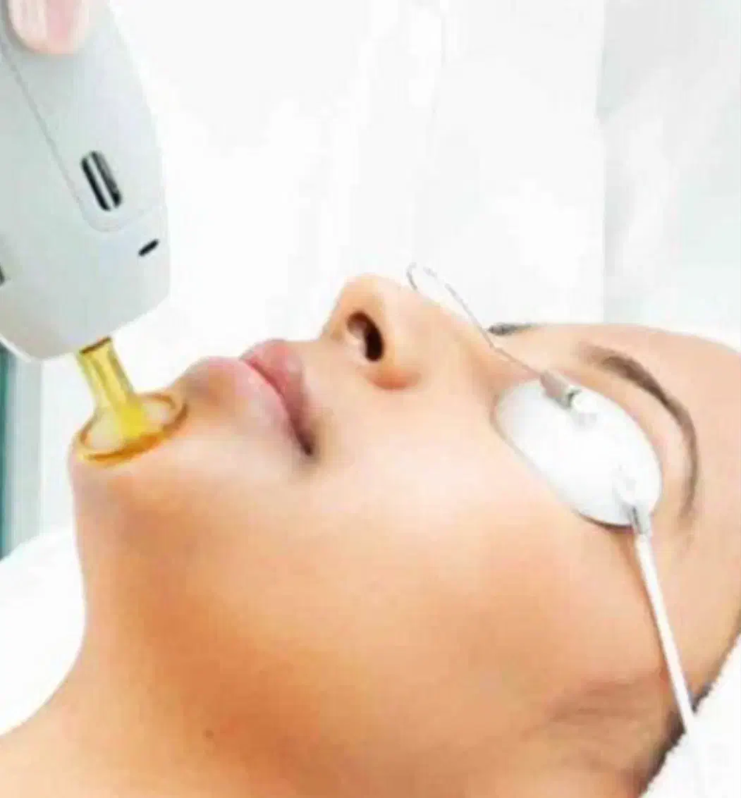 آف ویژه لیزرکندلا بدون ژل شاتی سری شخصی آمریکایی|خدمات آرایشگری و زیبایی|یاسوج, |دیوار