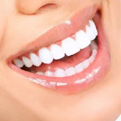 تکنسین کامپوزیت هستم|استخدام درمانی، زیبایی، بهداشتی|تهران, آجودانیه|دیوار