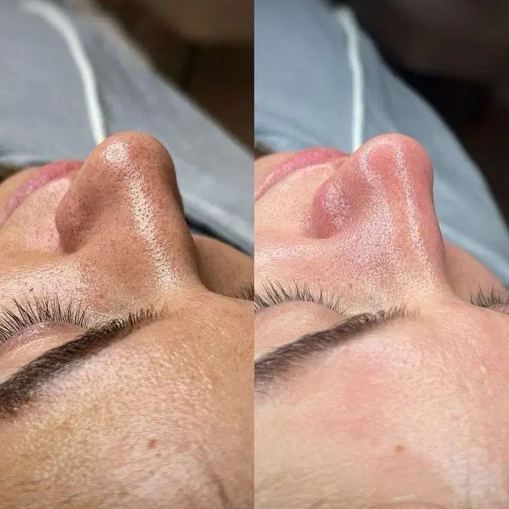 پاکسازی و جوانسازی صورت|خدمات آرایشگری و زیبایی|جم, |دیوار