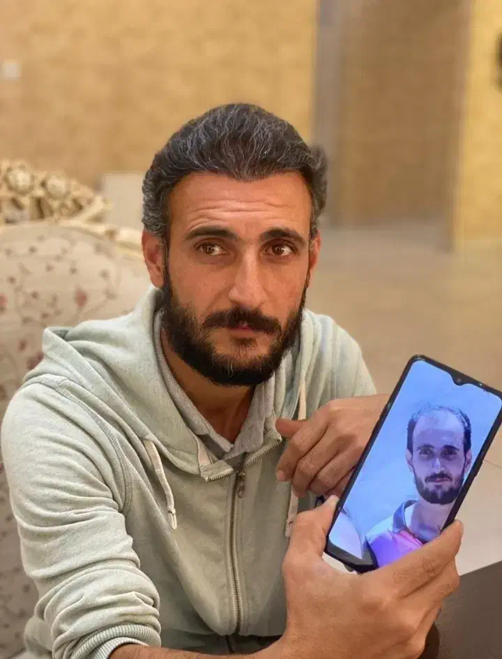 کاشت مو وابرو|خدمات آرایشگری و زیبایی|سقز, |دیوار