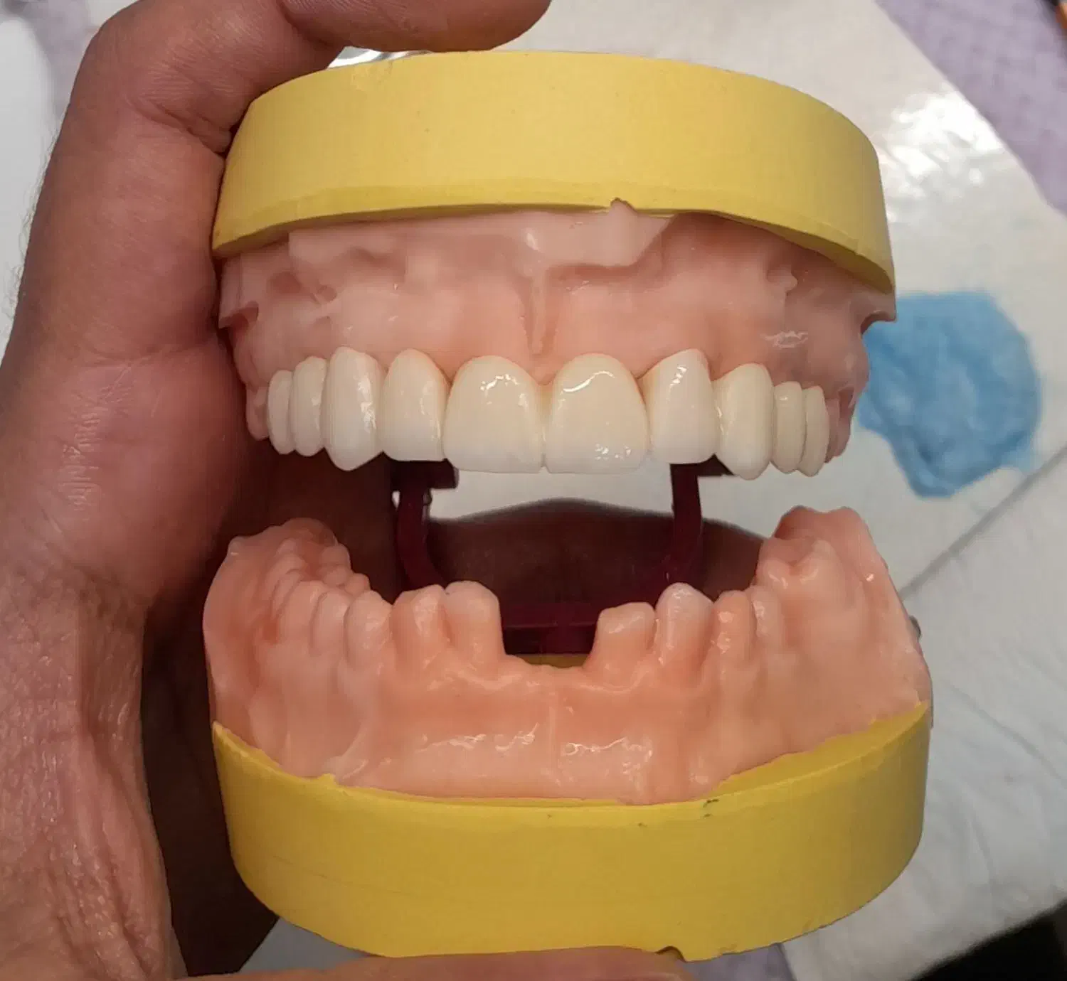 دندانسازی تاکستان|پزشکی|تاکستان, |دیوار