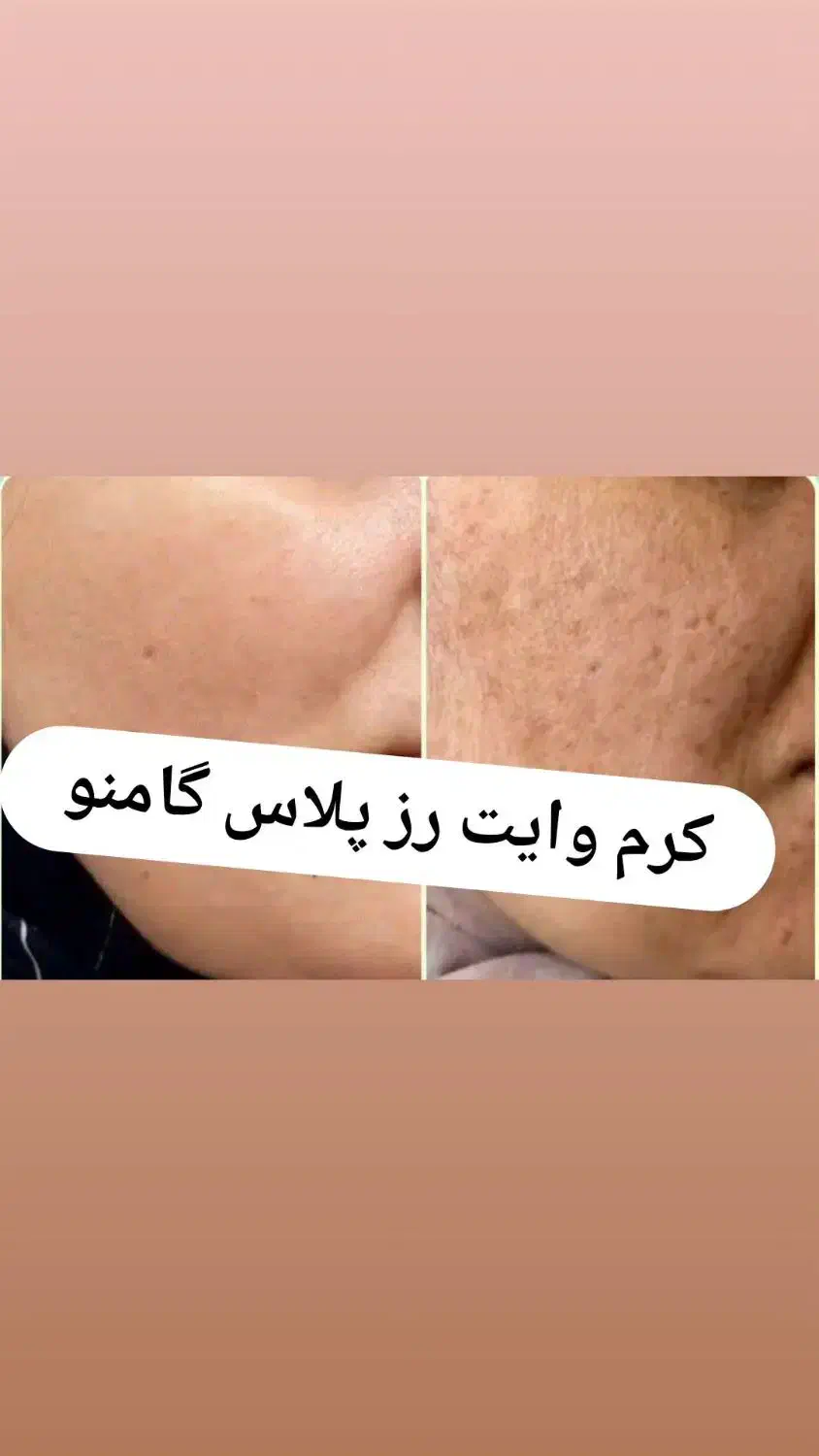 پک وایت رز پلاس|آرایشی، بهداشتی، درمانی|جهرم, |دیوار