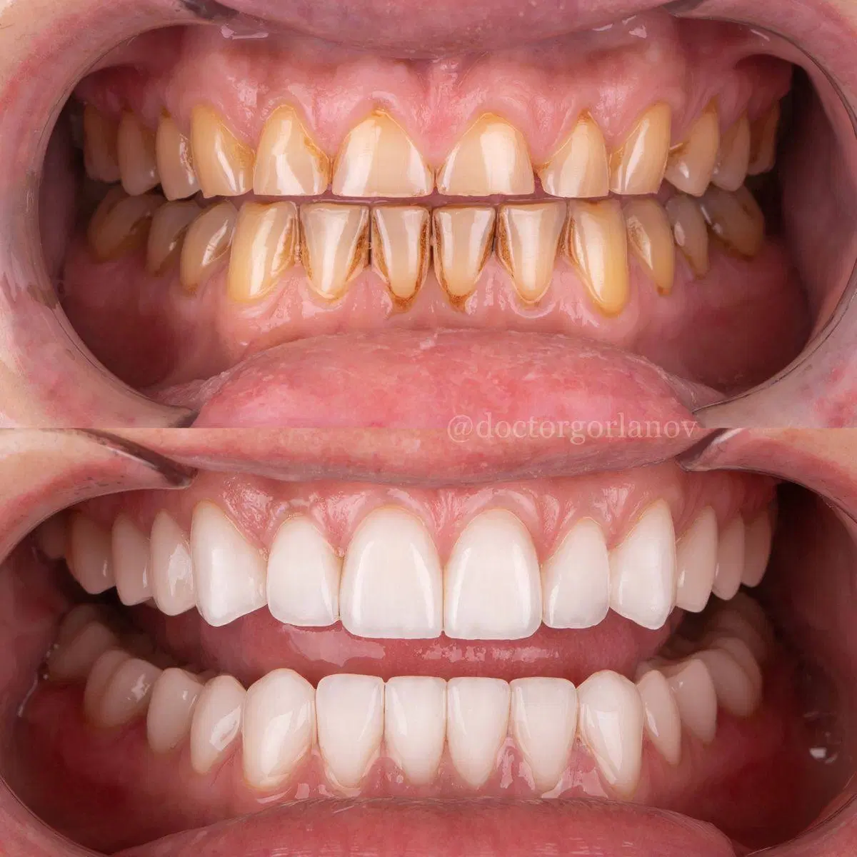 اوردنچر فقط تااخر این هفته به قیمت پارسال|خدمات زیبایی و سلامت|تبریز, |دیوار