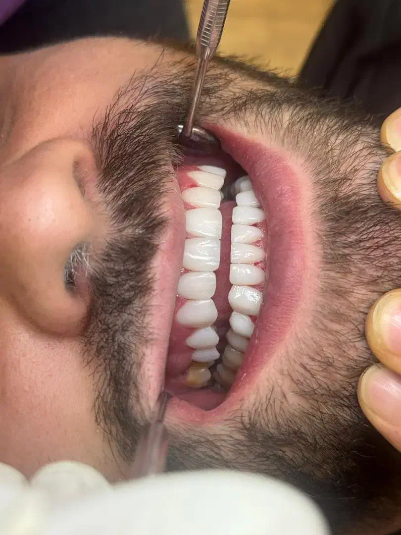 دستیار دندانپزشکی|استخدام درمانی، زیبایی، بهداشتی|تهران, جردن|دیوار