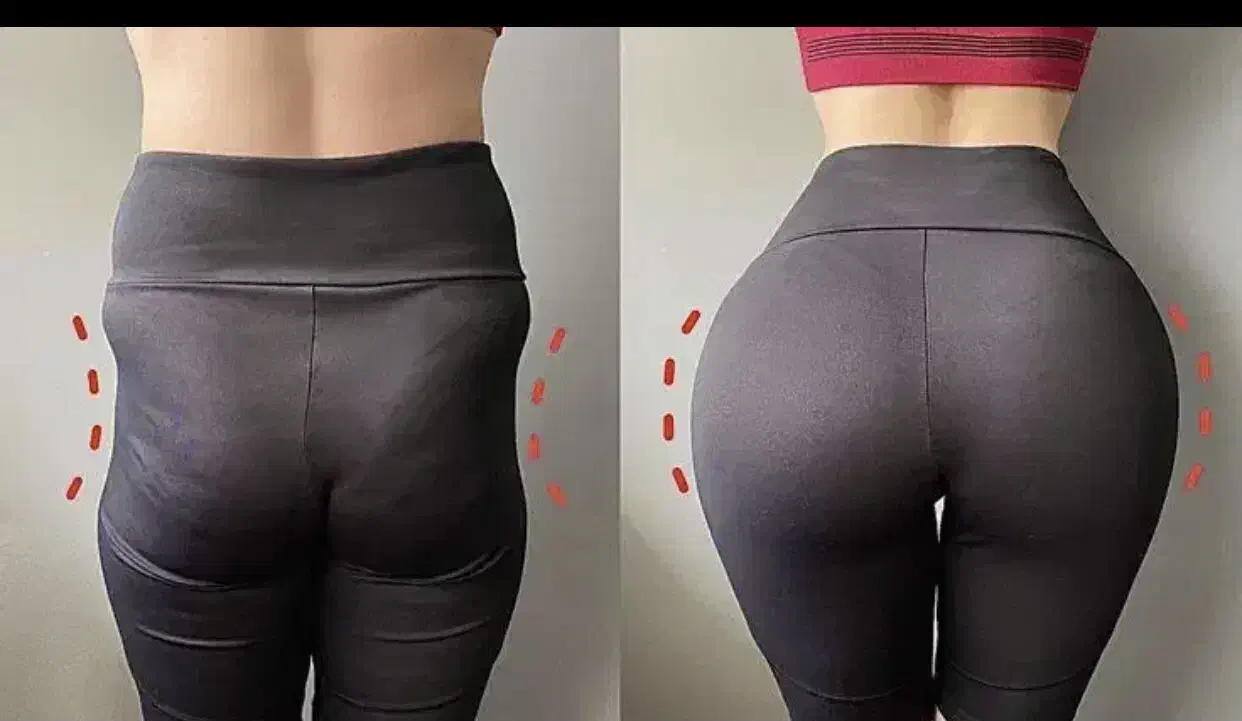 فیلربادی۱۰۰سیسی۱۱تومن باسن هیپ دیپ وآموزش فقط ۷۹۰۰|خدمات آرایشگری و زیبایی|کرج, گوهردشت|دیوار