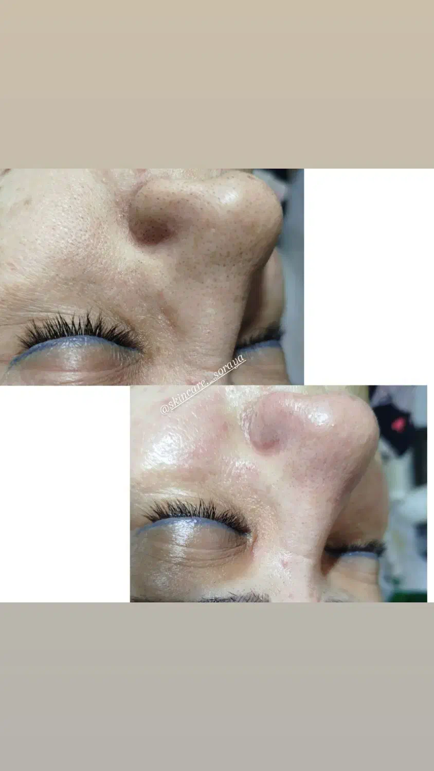 پاکسازی وفیشال|خدمات آرایشگری و زیبایی|شهریار, شهریار|دیوار