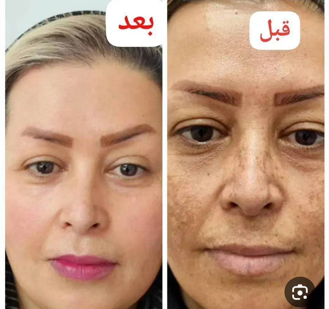 محصولات ضدلک|آرایشی، بهداشتی، درمانی|قم, آرامستان بهشت معصومه|دیوار