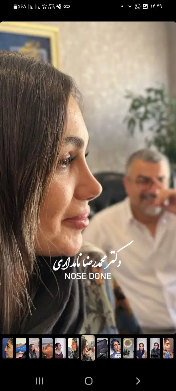 جراحی بینی با قیمت استثنایی در تهران فقط ۳۱ میلیون|خدمات آرایشگری و زیبایی|ساری, |دیوار