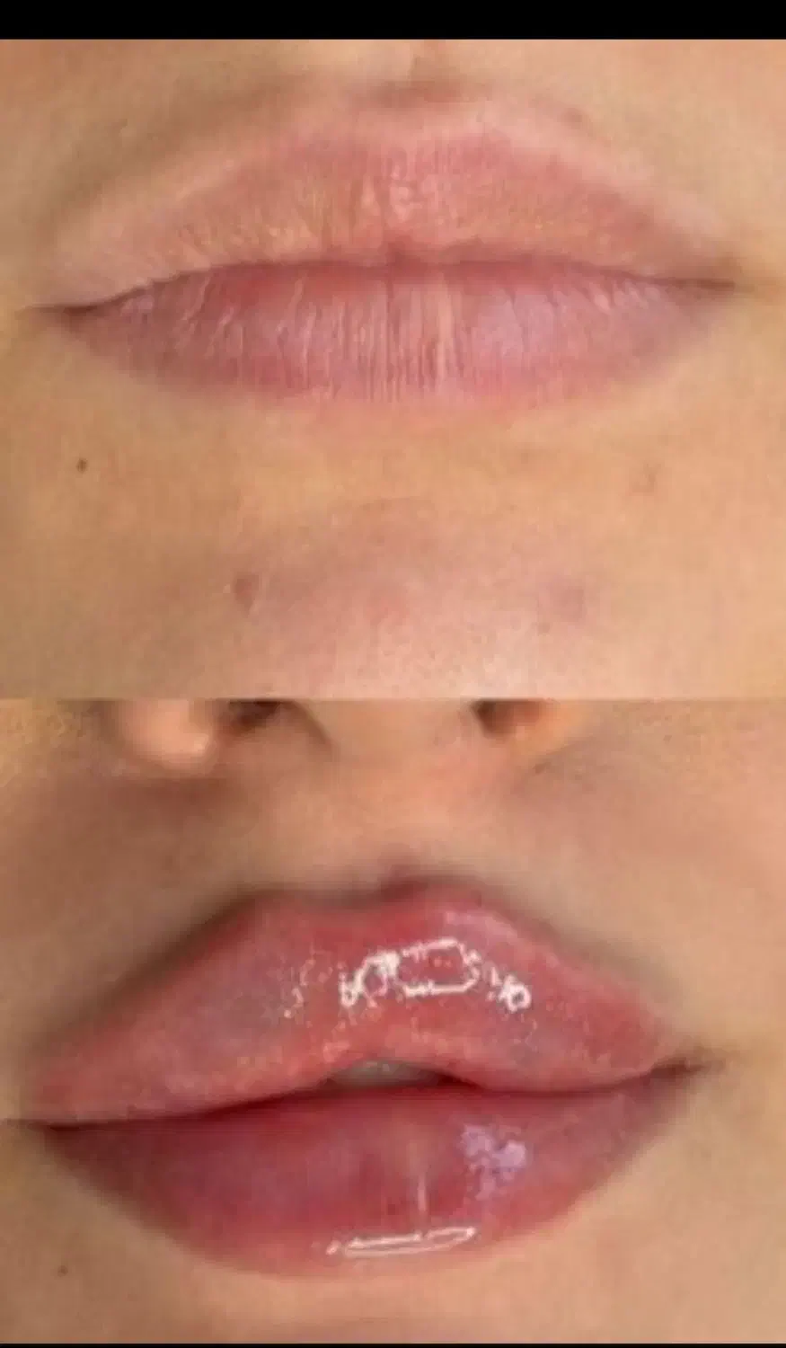 کاشت مو و کاشت ابرو اقساطی و تضمینی|خدمات آرایشگری و زیبایی|ارومیه, |دیوار