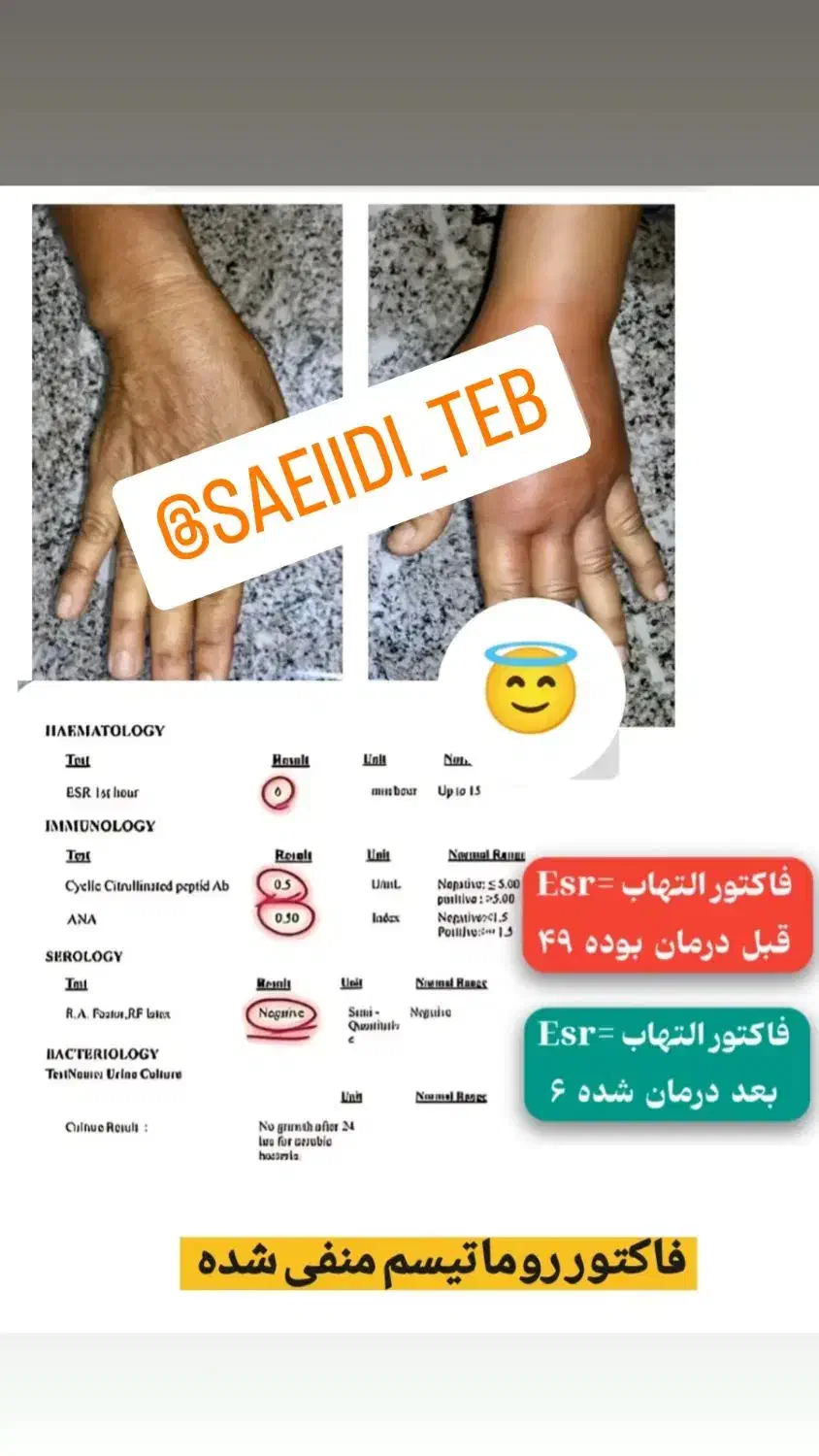 رماتیسم،نقرس ،ارتریت روماتوئید|آرایشی، بهداشتی، درمانی|بندر انزلی, گیلار|دیوار