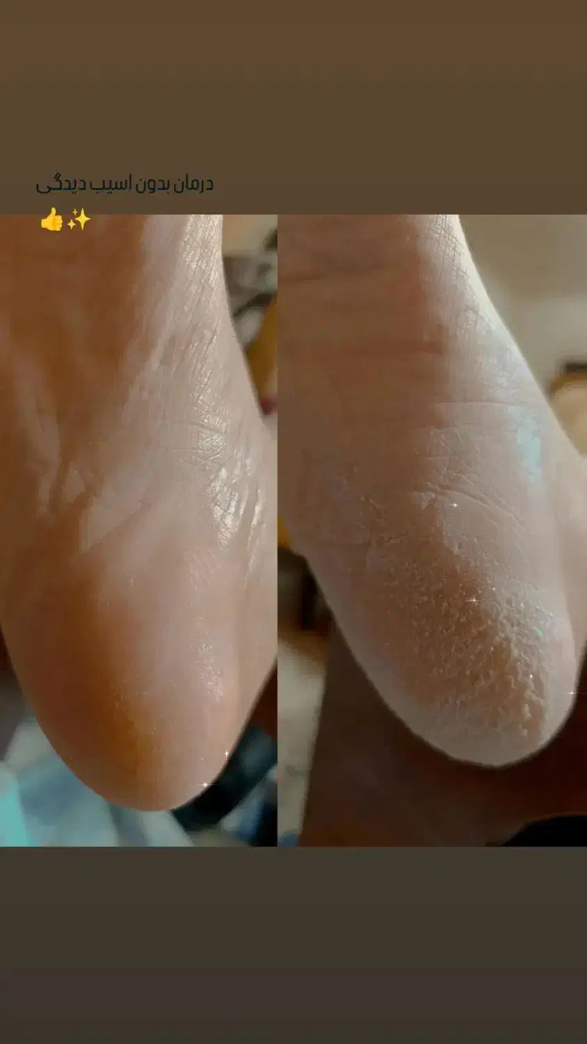 انواع خدمات کاشت ناخن و پدیکور پا کفسابی|خدمات آرایشگری و زیبایی|شاهین‌شهر, فردوسی|دیوار