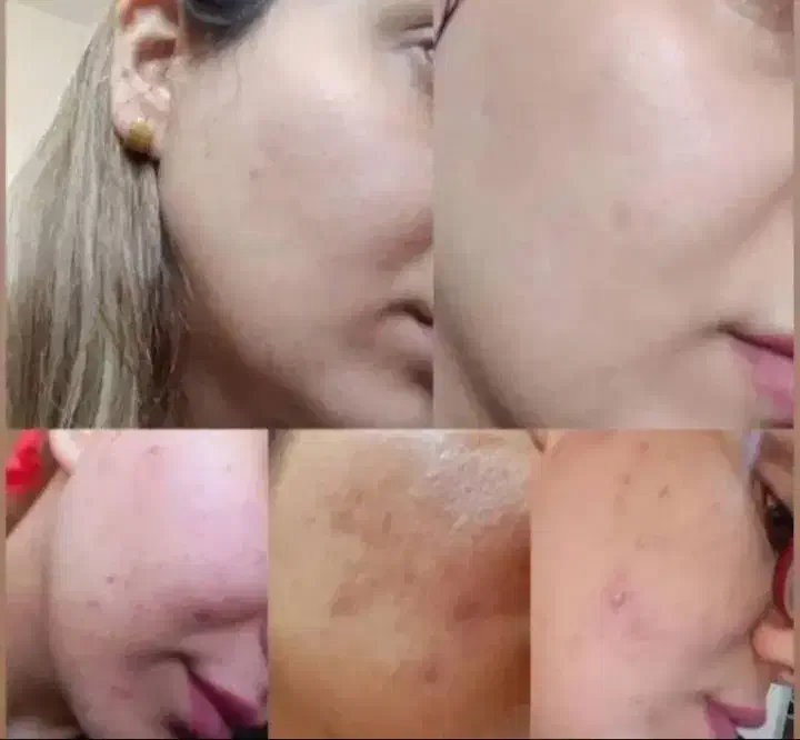 کرم وی ای پی اصل صدرصد تضمینی و بدون بازگشت|آرایشی، بهداشتی، درمانی|یاسوج, |دیوار