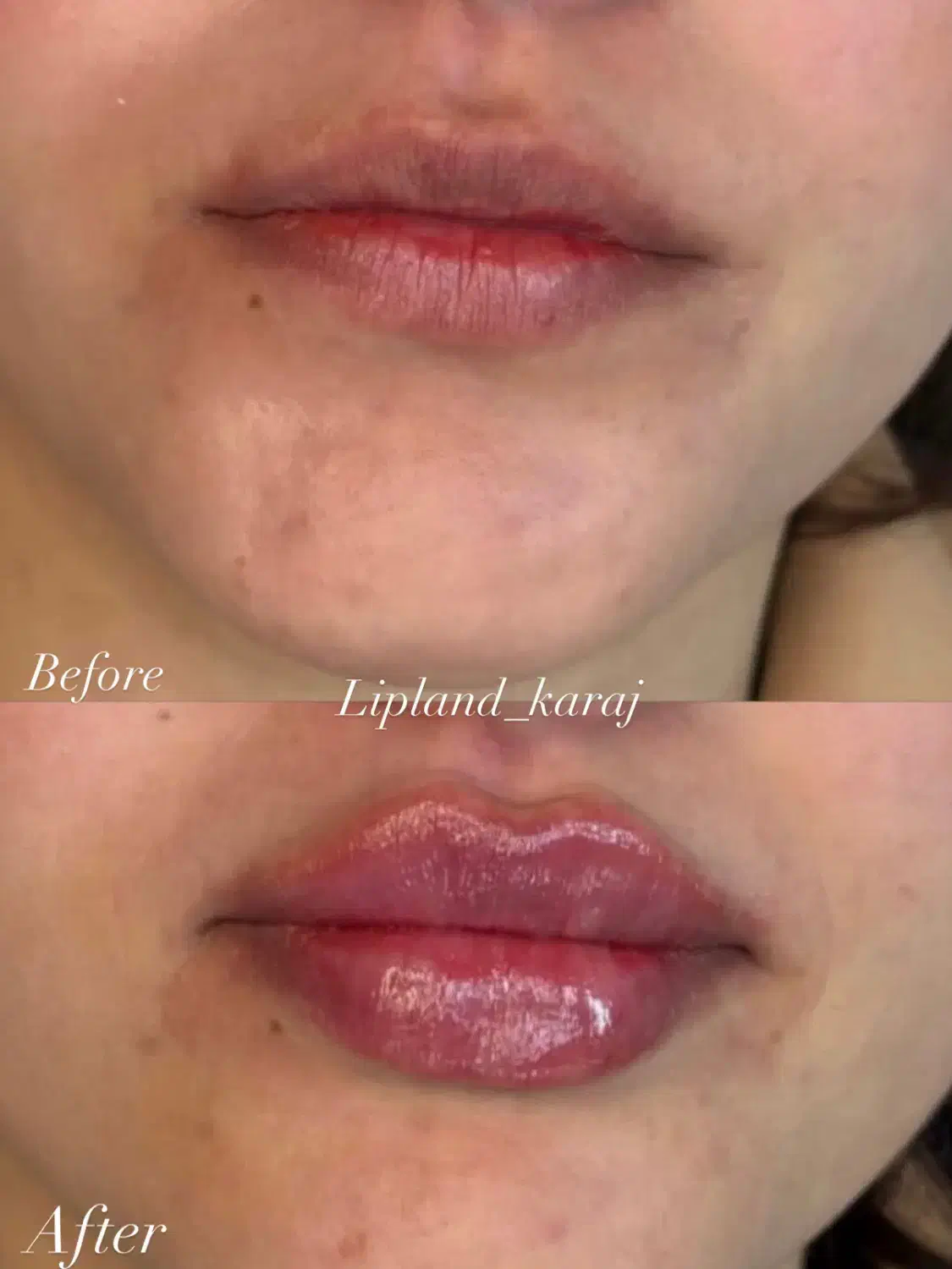 جشنواره تخفیف ژل لب و بوتاکس|خدمات آرایشگری و زیبایی|کرج, خرمدشت|دیوار