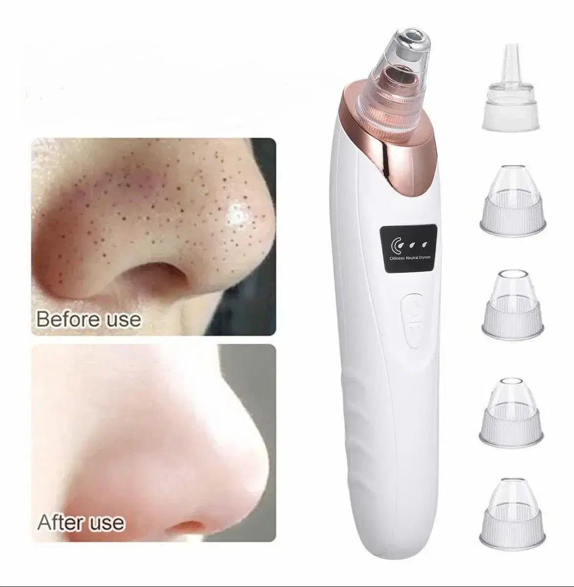 دستگاه میکرودرم|آرایشی، بهداشتی، درمانی|زابل, |دیوار