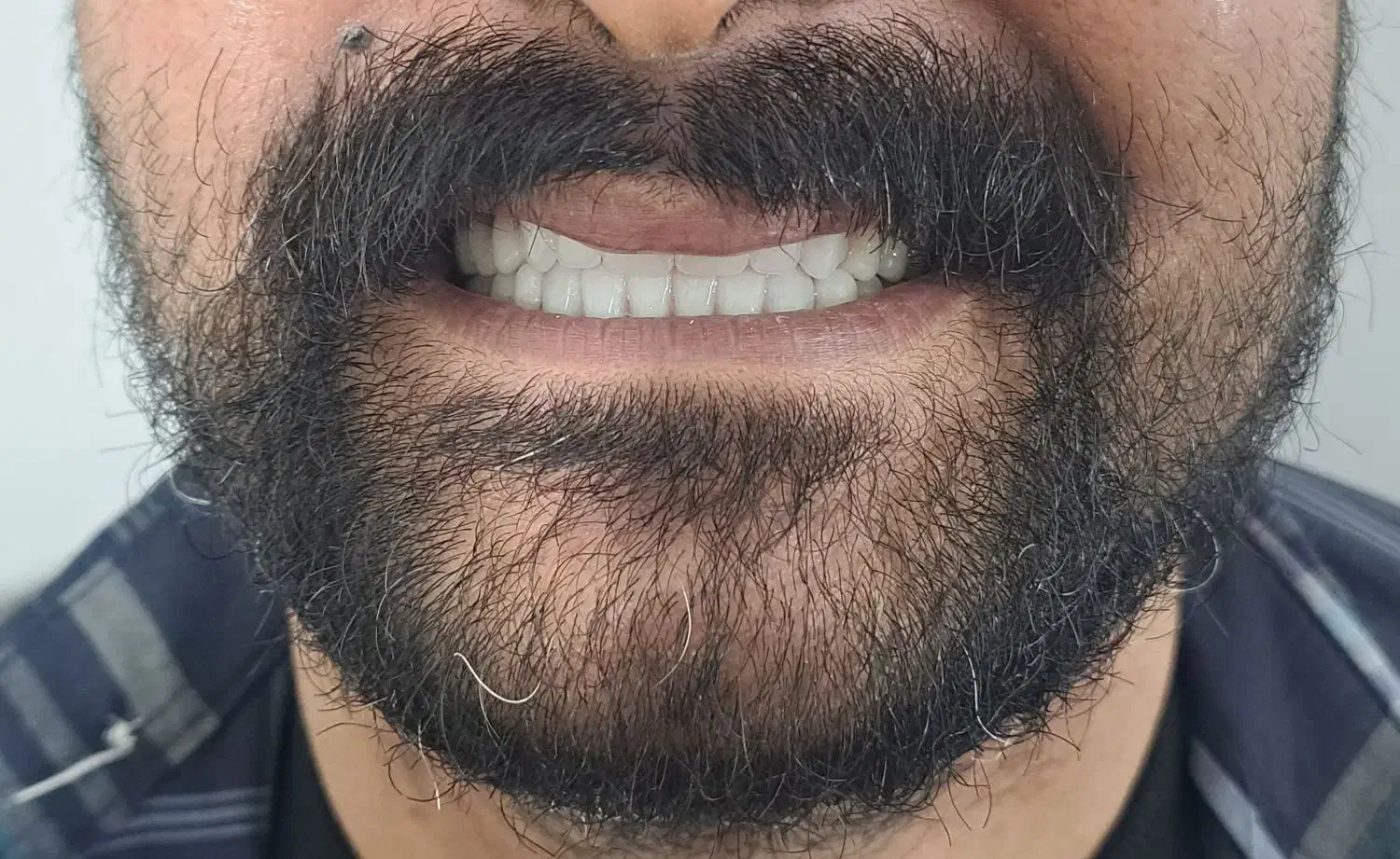 دندانسازی تخصصی|خدمات آرایشگری و زیبایی|بهبهان, |دیوار