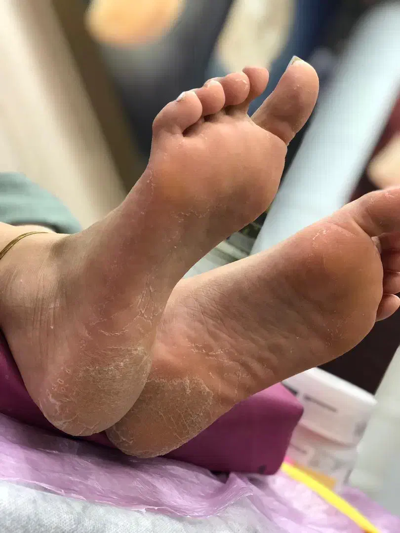 تخفیف ویژه پدیکور پا|خدمات آرایشگری و زیبایی|تبریز, |دیوار