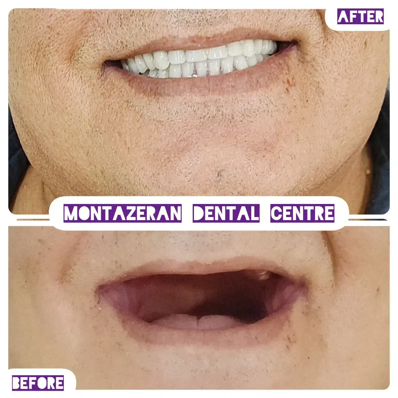 دندانسازی دندانساز دندان مصنوعی دندان باضمانت|آرایشی، بهداشتی، درمانی|مشهد, کوشش|دیوار