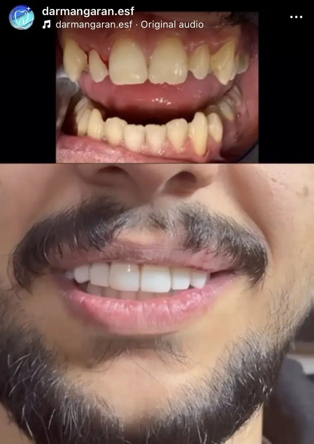 جشنواره دندانپزشکی (تمامی خدمات)|خدمات آرایشگری و زیبایی|اصفهان, لنبان|دیوار