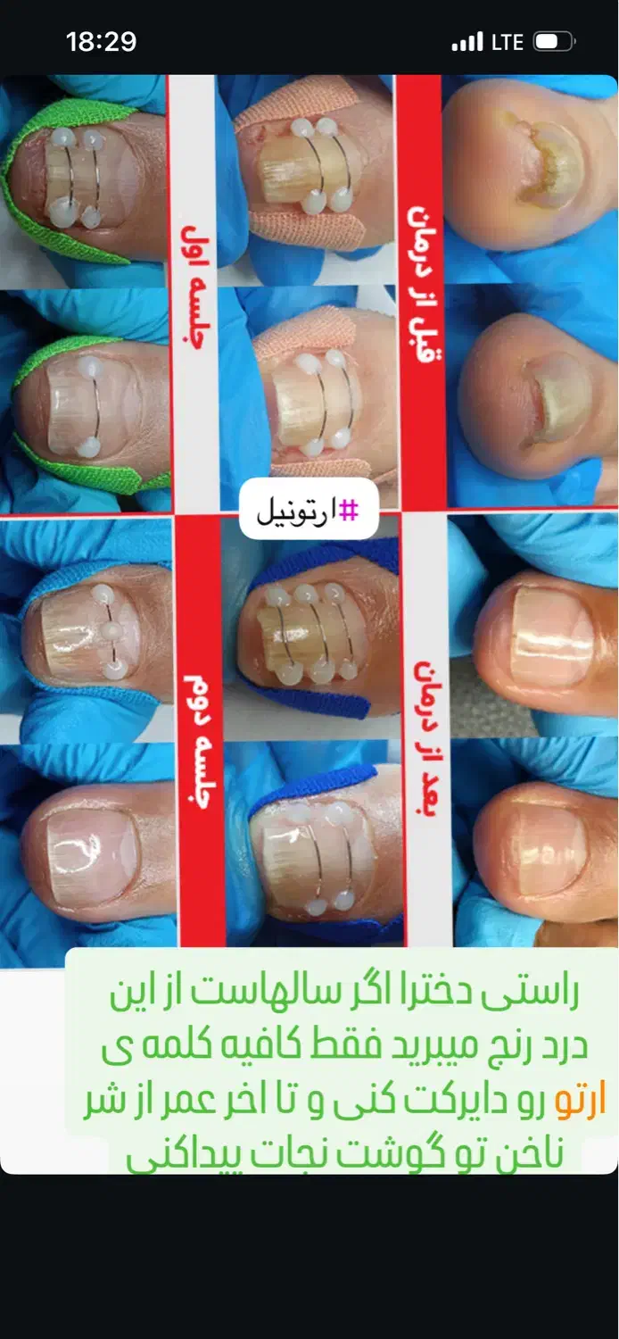 آموزش پدیکور و پارافین تراپی و ارتونیل|خدمات آموزشی|اصفهان, مرداویج|دیوار