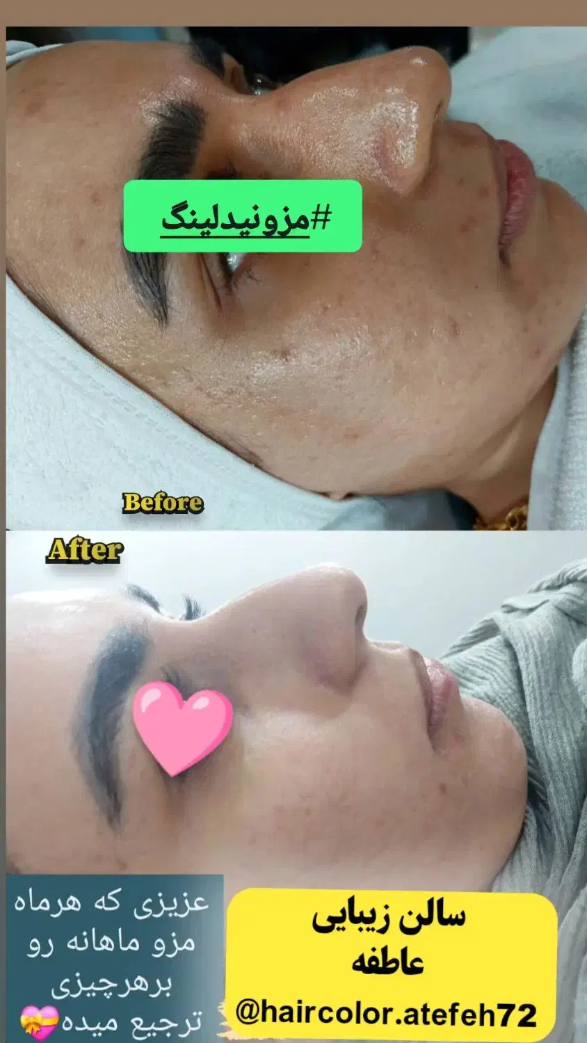 فقط هزینه مواد|خدمات آرایشگری و زیبایی|آزادشهر, |دیوار