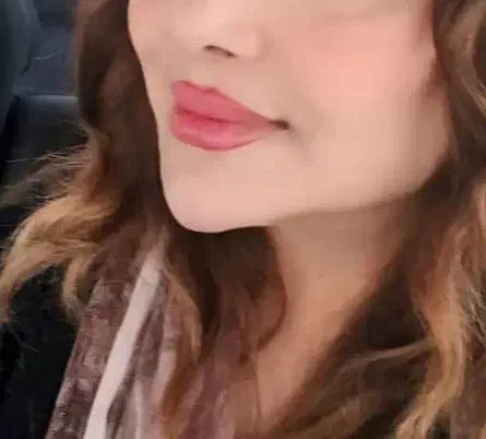 ژل وبوتاکس ومزونیدلینگ وحجامت|خدمات آرایشگری و زیبایی|فولادشهر, B2|دیوار