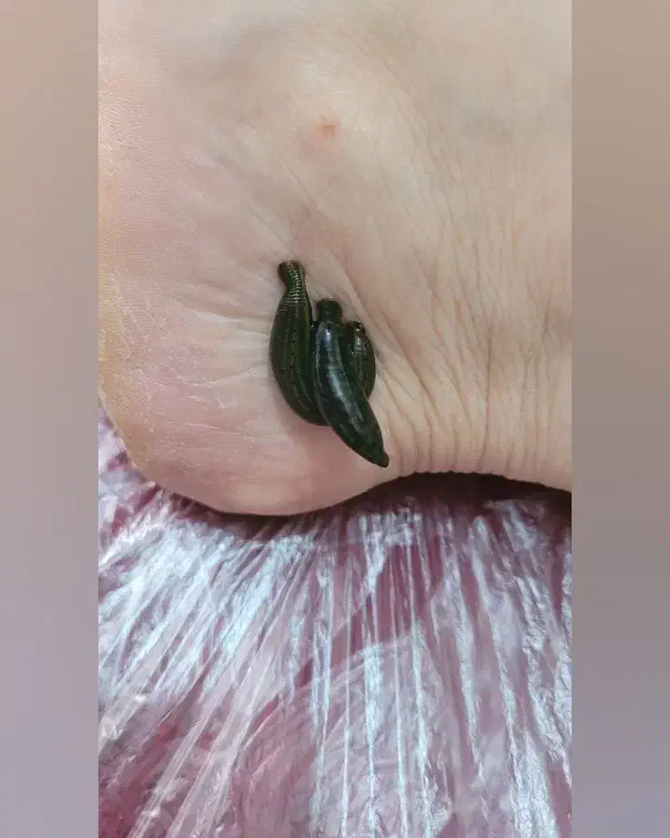 فروش زالو درجه یک|خزنده|یزد, |دیوار